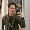 Kiki Farrel Merawat Rambut Usai Transplantasi