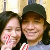 Kondisi Abdee SLANK Akibat Sakit IgA Nephropathy