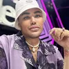 Bibir Ivan Gunawan Tebal