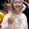 Idol K-Pop dengan Penglihatan Buruk