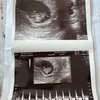 Alasan Jessica Iskandar Jalani Program Bayi Tabung