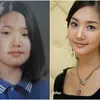 Park Min Young