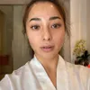 Nikita Willy berjerawat