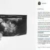 Baby Bump Ayudia Bing Slamet