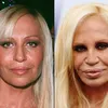 Seleb Yang Lakukan Lip Injections