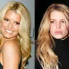 Seleb Yang Lakukan Lip Injections