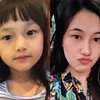 Elea dan Anesstesia