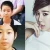 Oplas Seleb Korea