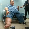 rony dozer kaki bengkak