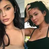 bibir kylie jenner