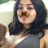 Kylie Jenner Implan Payudara