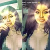 Kylie Jenner Implan Payudara