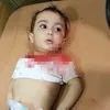 foto Omran Daqneesh bocah Suriah