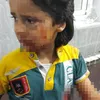 foto Omran Daqneesh bocah Suriah