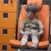 foto Omran Daqneesh bocah Suriah