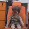 foto Omran Daqneesh bocah Suriah
