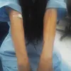 570