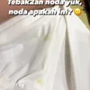 Tasya Kamila alami robek jahitan operasi