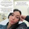 Kondisi Terbaru Asmirandah Setelah Mendapat Jahitan