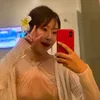 Lee Se Young Filler Payudara Pecah