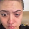 Kondisi Mata Marsha Aruan