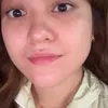 Kondisi Mata Marsha Aruan