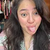 Marshanda Selfie Jerawat