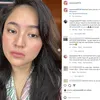 Marshanda Selfie Jerawat