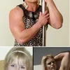 Efek Samping Steroid
