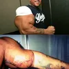 Efek Samping Steroid
