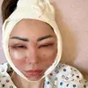 Femmy Permatasari Setelah Oplas di Kore