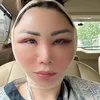Femmy Permatasari Setelah Oplas di Kore