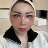 Femmy Permatasari Setelah Oplas di Kore