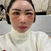 Femmy Permatasari Setelah Oplas di Kore