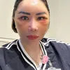 Femmy Permatasari Setelah Oplas di Kore