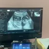 Potret Temmy Rahadi dan Sang Putri yang Dinantikan Selama 6 Tahun Kehadirannya