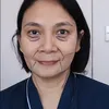 Wajah Dian Nitami Setelah Sebulan Melakukan Face Lifting