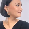 Wajah Dian Nitami Setelah Sebulan Melakukan Face Lifting