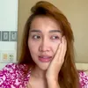 Proses Lucinta Luna Ganti Kepala Alias Operasi Plastik