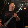 dying fetus