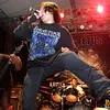 dying fetus