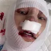 Potret Lucinta Luna usai oplas lagi.
