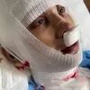 Potret Lucinta Luna usai oplas lagi.