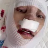 Potret Lucinta Luna usai oplas lagi.