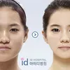 Foto Operasi Plastik Korea