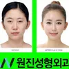 Foto Operasi Plastik Korea
