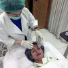selebriti yang tanam benang, treatment tanam benang