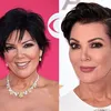 Artis Hollywood Operasi Plastik