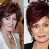 Artis Hollywood Operasi Plastik