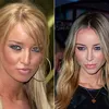 Artis Hollywood Operasi Plastik
